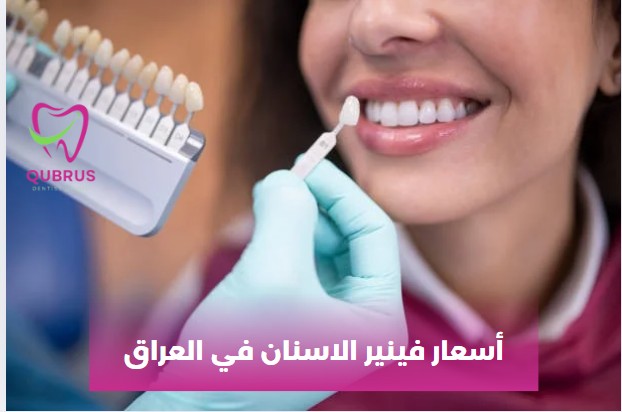 أسعار فينير الاسنان في العراق