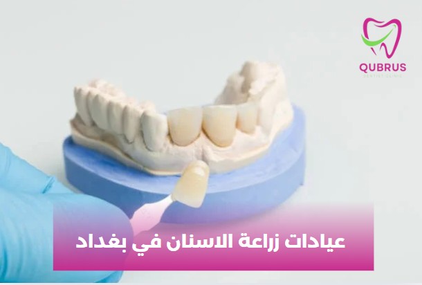 أفضل طبيب اسنان في بغداد