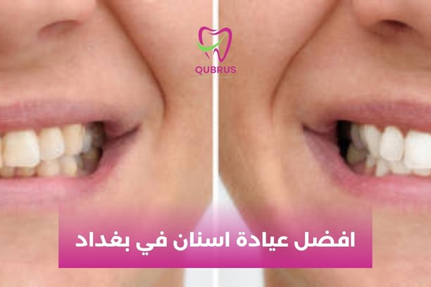 ما هو رقم افضل عيادة اسنان في بغداد؟