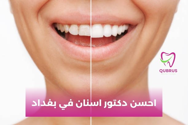 دكتور اسنان في بغداد الجديدة