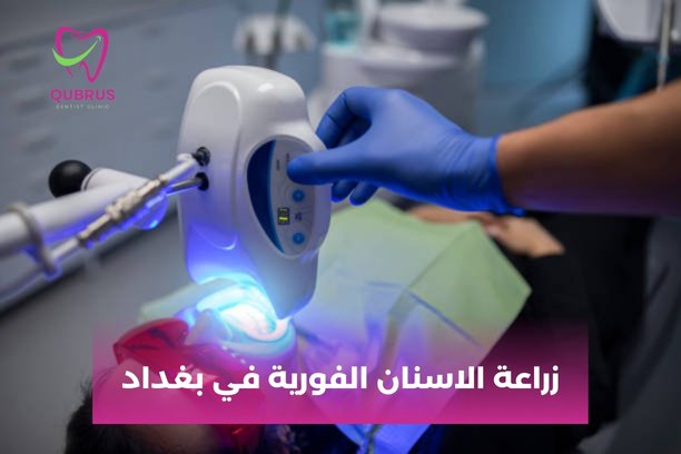 هل يمكنني إجراء زراعة الاسنان الفورية في بغداد إذا كنت قد خضعت لجراحة سابقة في الفك؟