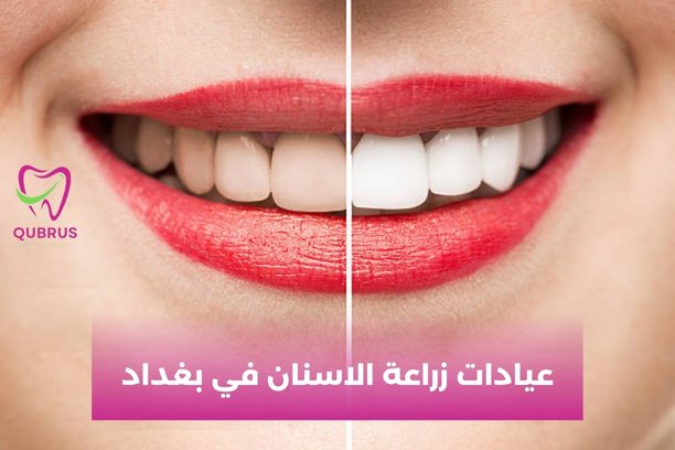 دكتور اسنان في شارع فلسطين