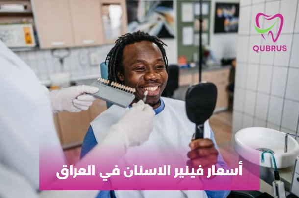 أسعار فينير الاسنان في العراق