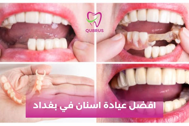 افضل عيادة اسنان في بغداد