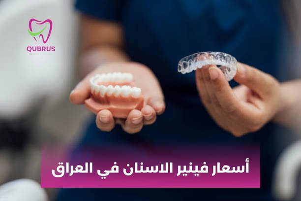 سعر الفينير المتحرك