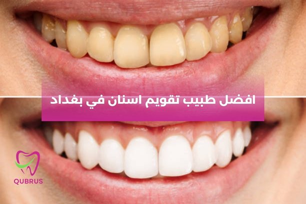 افضل طبيب تقويم اسنان في بغداد