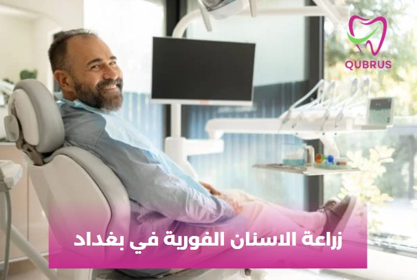 زراعة الاسنان الفورية في بغداد