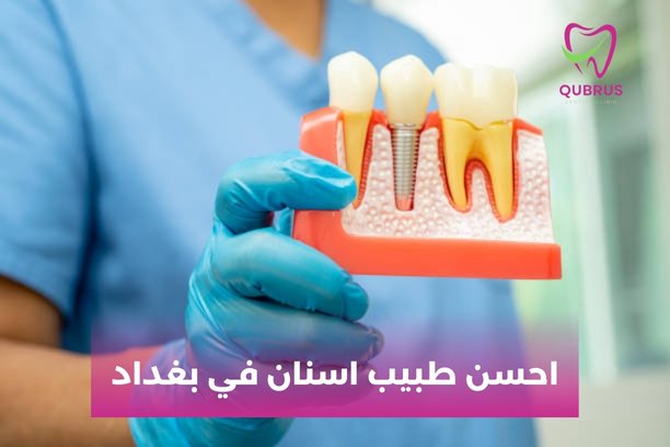 من هو احسن طبيب اسنان في بغداد ؟