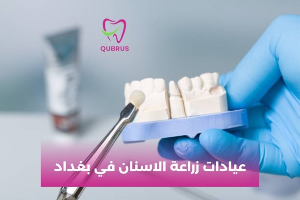 أفضل طبيب زراعة اسنان في بغداد