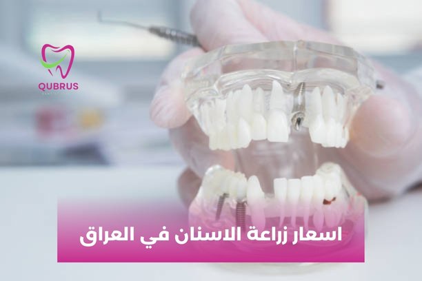 سعر زراعة الأسنان الفورية