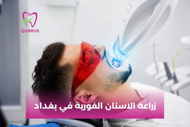 زراعة الاسنان في بغداد