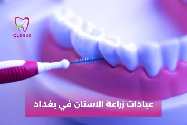 افضل طبيب اسنان في العراق