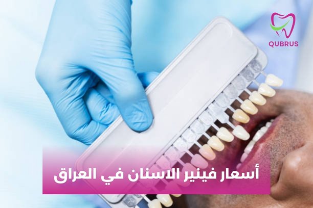 هل يوجد فرق بين زراعة الأسنان والفينير؟