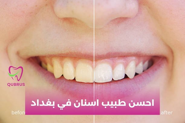 احسن طبيب اسنان في بغداد