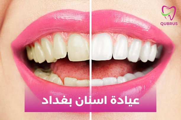 عيادات اسنان في بغداد