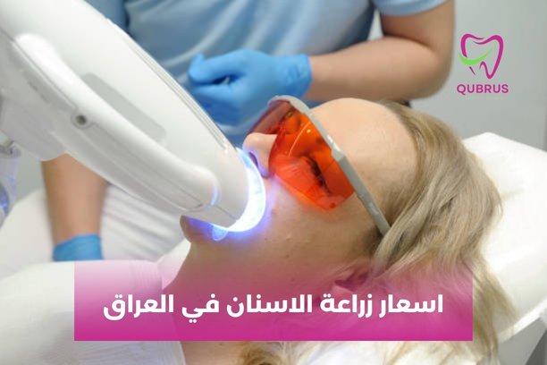 كم سعر تغليف الأسنان في العراق