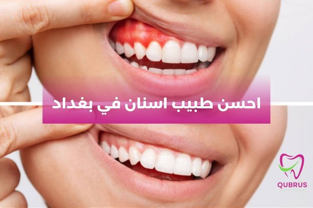 احسن طبيب اسنان