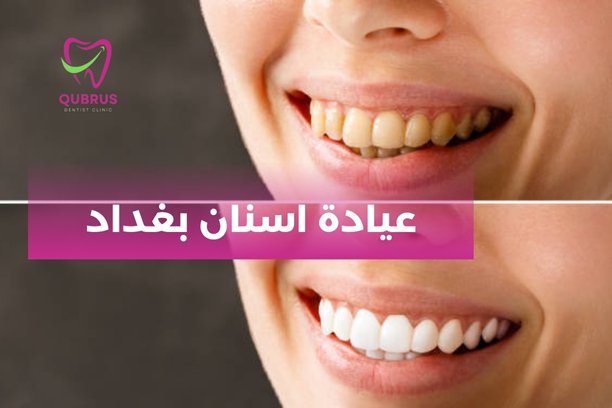 ما هي إجراءات السلامة المتبعة في عيادة اسنان بغداد؟