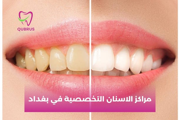 المراكز التخصصية لطب الاسنان في بغداد