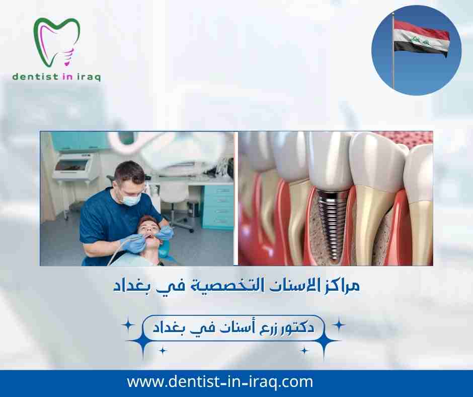 مراكز الاسنان التخصصية في بغداد