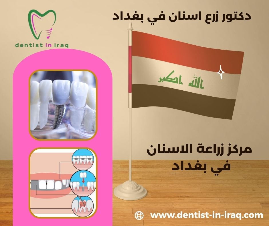 مركز زراعة الاسنان في بغداد