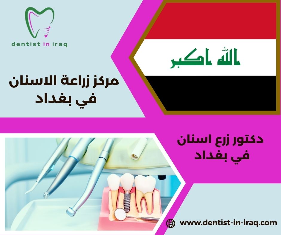 أفضل مركز زراعة اسنان في بغداد أفضل مركز زراعة اسنان في بغداد