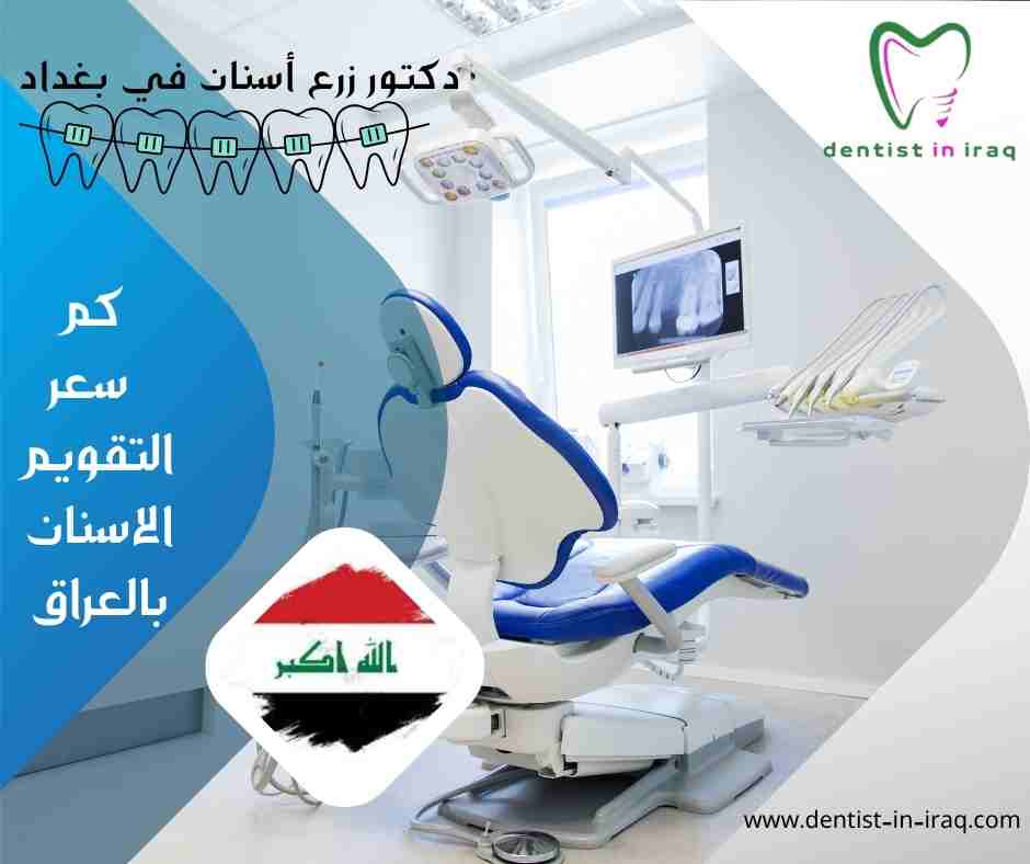 كم سعر التقويم الاسنان بالعراق