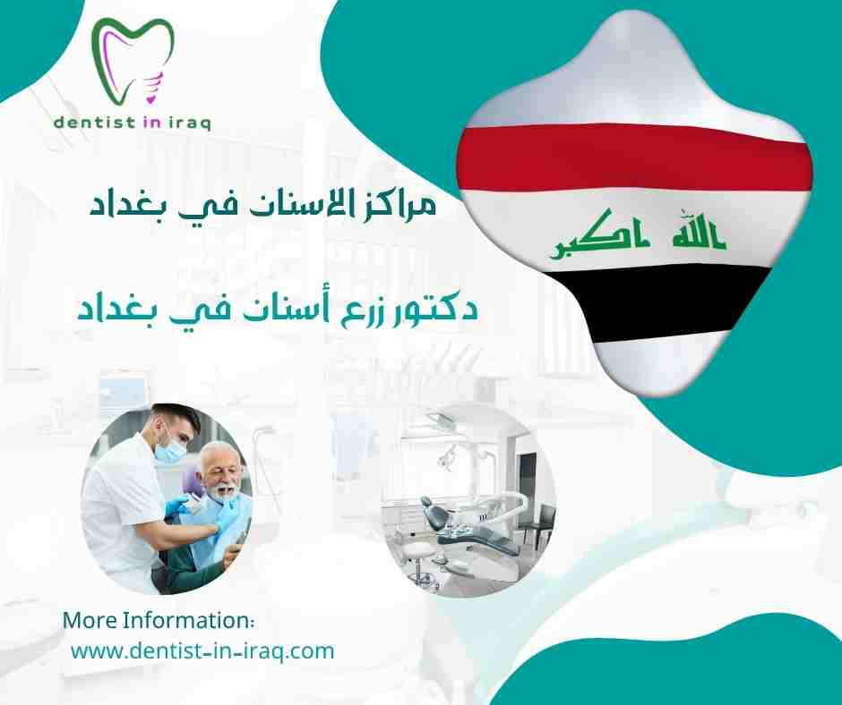 مراكز الاسنان في بغداد