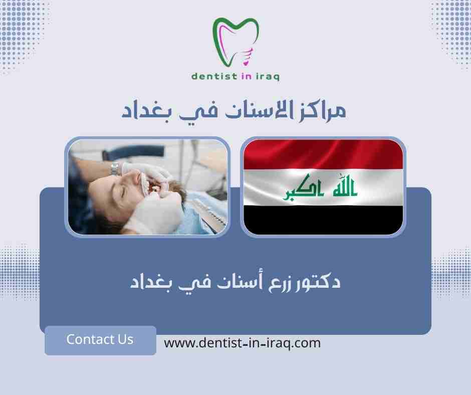مراكز الاسنان في بغداد