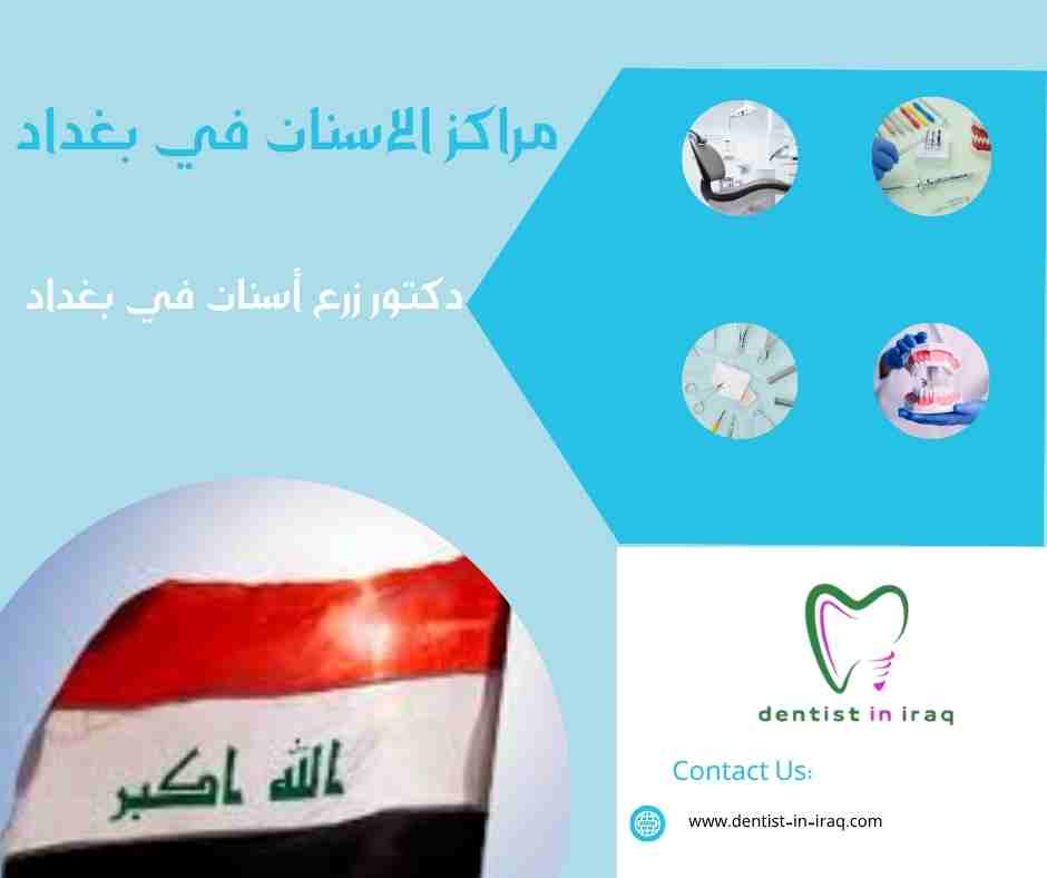 مراكز الاسنان في بغداد