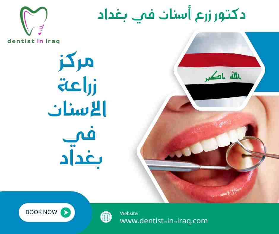 مركز زراعة الاسنان في بغداد