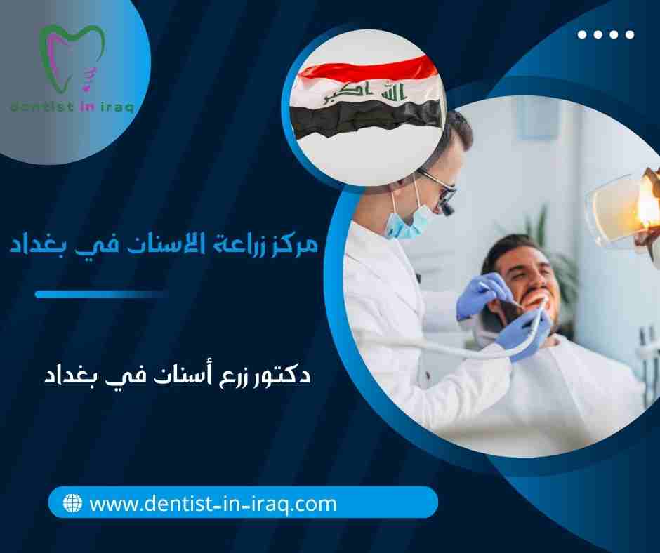 مركز زراعة الاسنان في بغداد