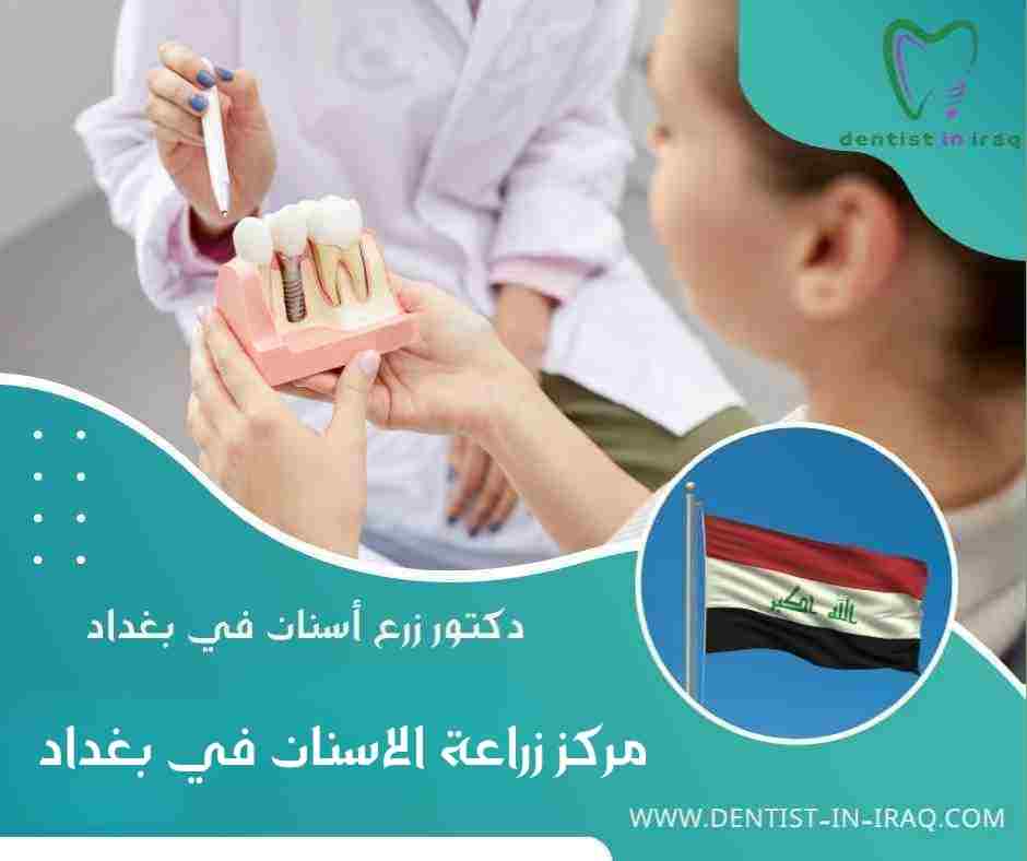 مركز زراعة الاسنان في بغداد