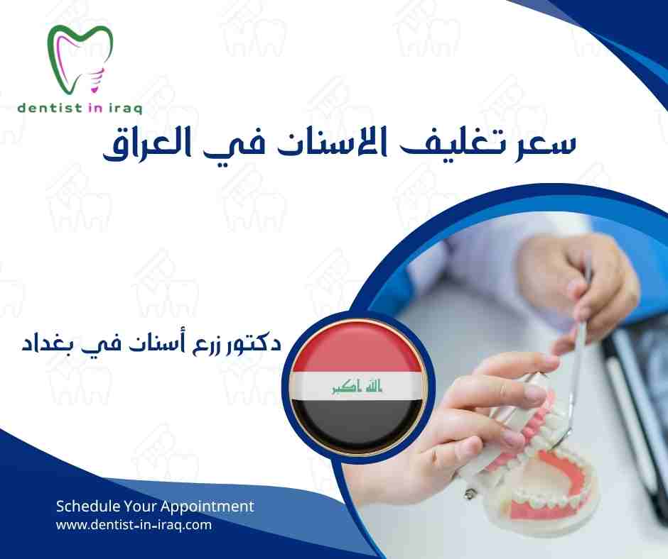 سعر تغليف الاسنان في العراق