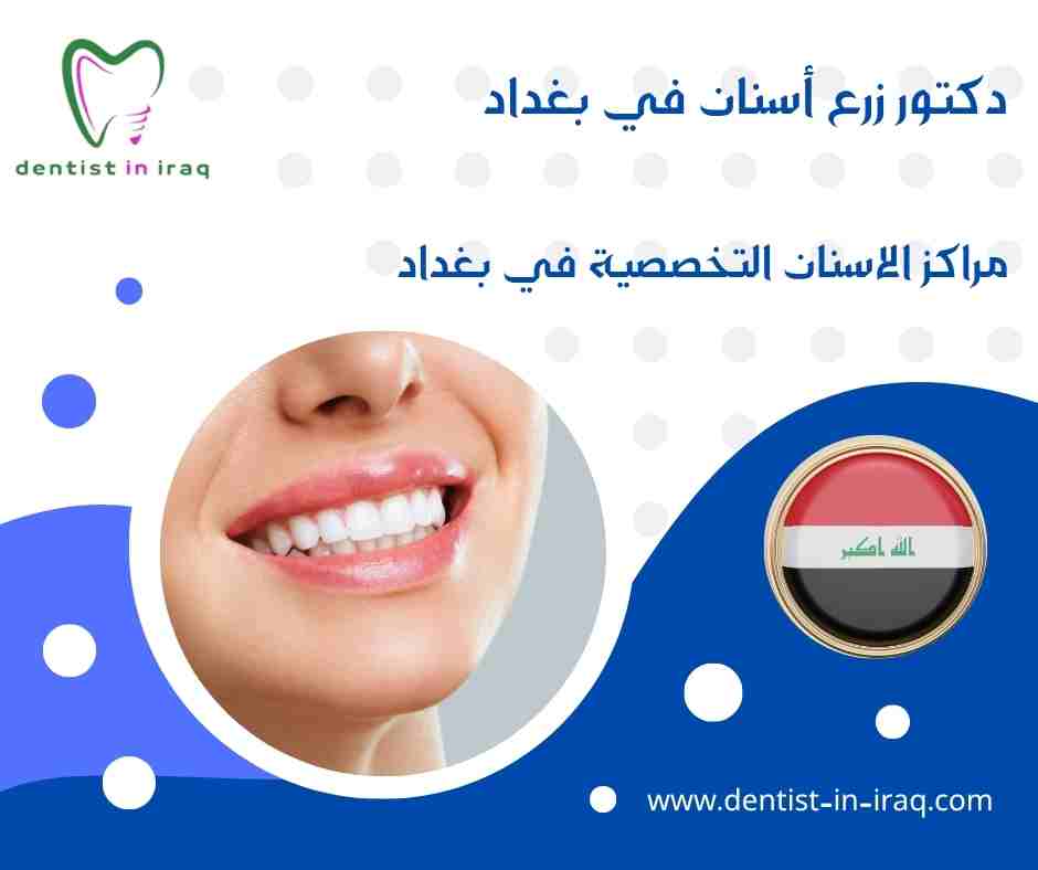 مراكز الاسنان التخصصية في بغداد