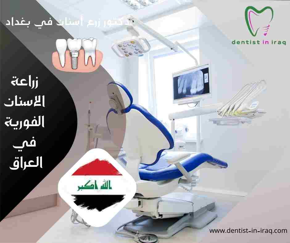 زراعة الاسنان الفورية في العراق