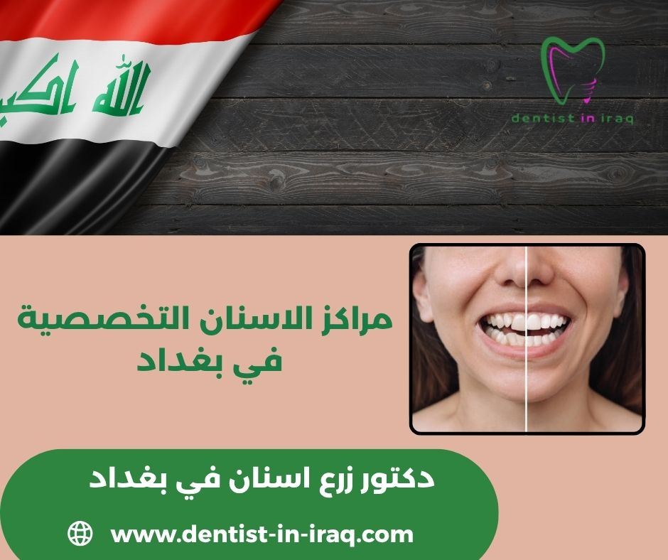 مراكز الاسنان التخصصية الحكومية في بغداد