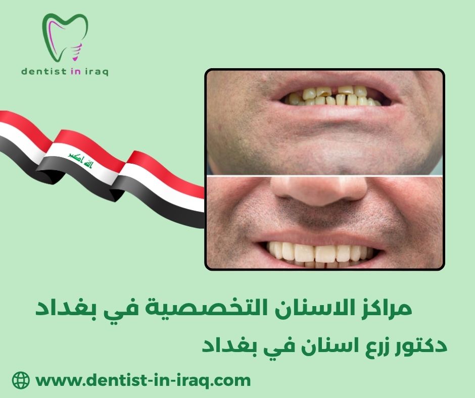 مركز الاسنان التخصصي