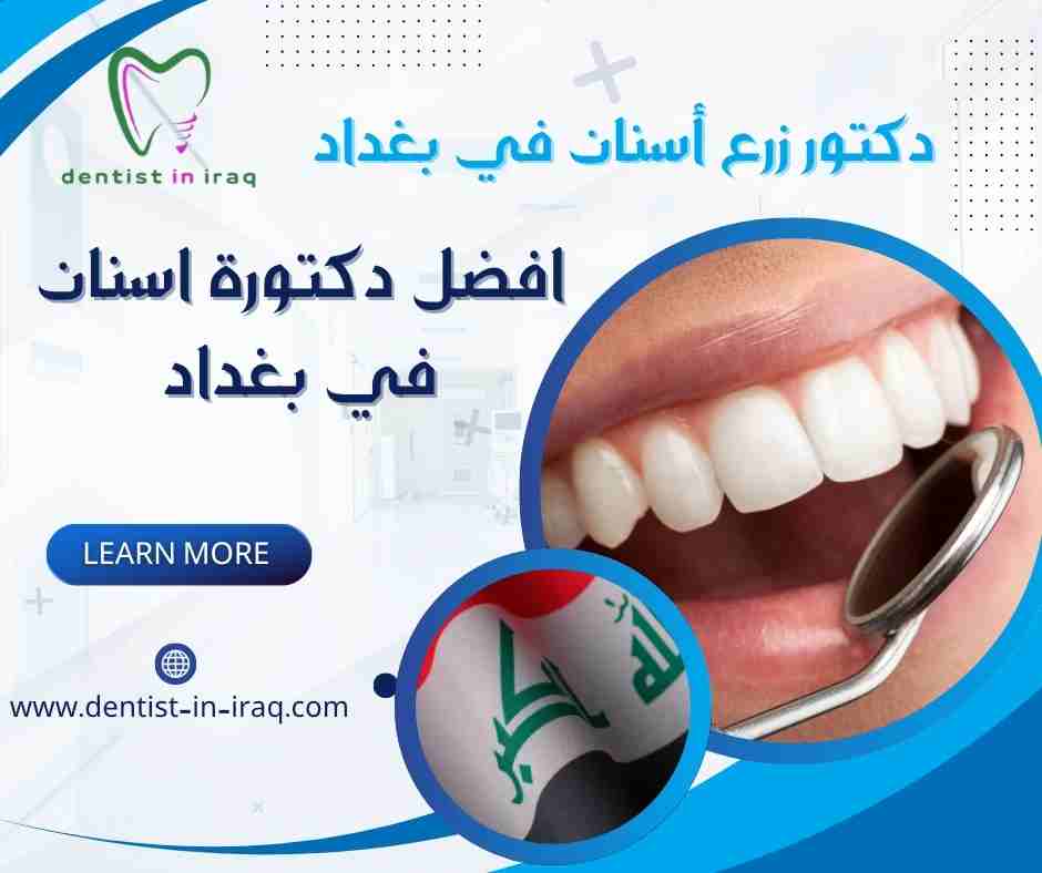 افضل دكتورة اسنان في بغداد