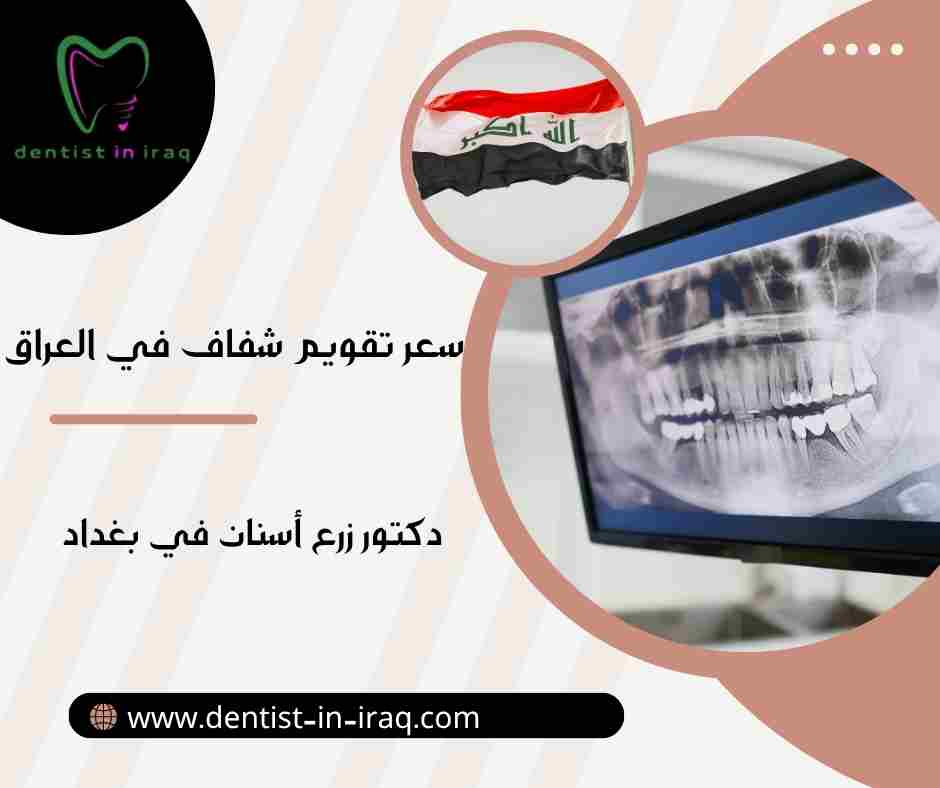 سعر تقويم شفاف في العراق