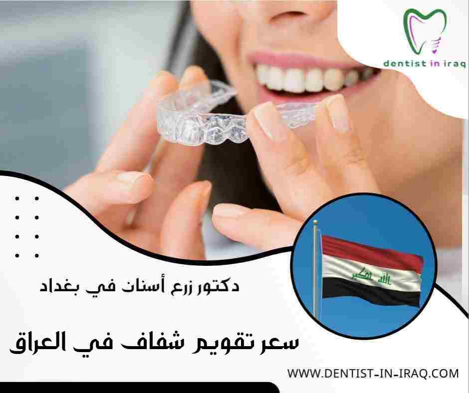 سعر تقويم شفاف في العراق