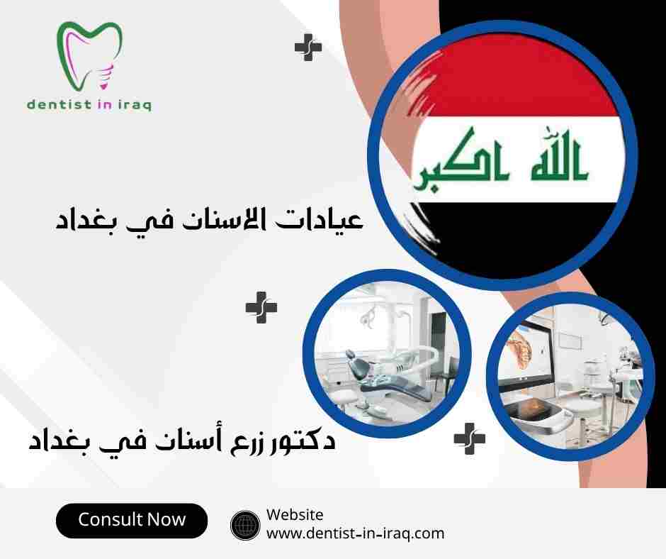 عيادات الاسنان في بغداد