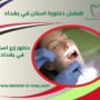 افضل دكتورة اسنان في بغداد