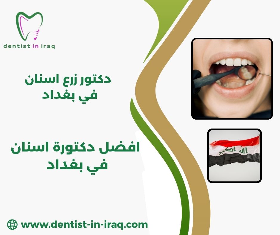 افضل اطباء اسنان في بغداد افضل اطباء اسنان في بغداد