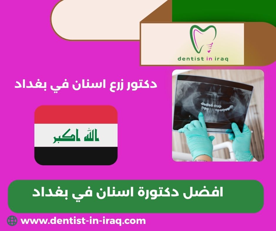 افضل عيادة اسنان في بغداد افضل عيادة اسنان في بغداد