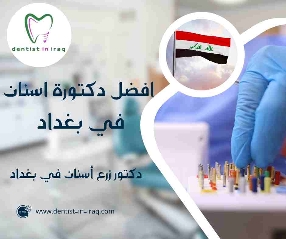 افضل دكتورة اسنان في بغداد