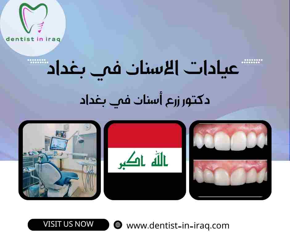 عيادات الاسنان في بغداد