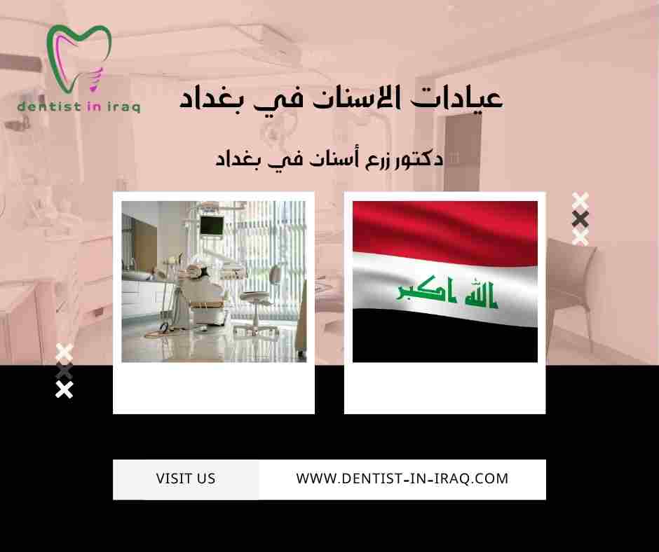 عيادات الاسنان في بغداد