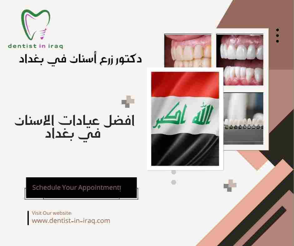 افضل عيادات الاسنان في بغداد
