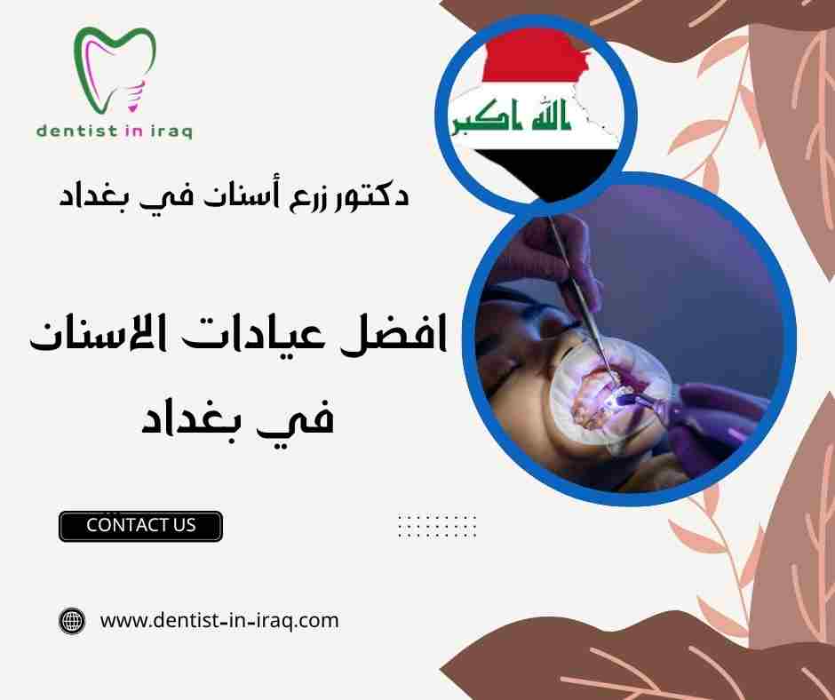 افضل عيادات الاسنان في بغداد